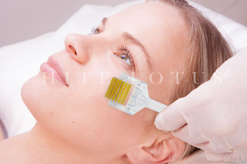 White Lotus Allergivennlig Dermaroller 1 mm 